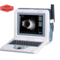 Namen der ophthalmologischen Ab Ultraschall Scan PT-CAS-2000ber, Modell B